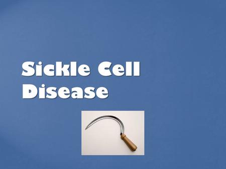   Sickle Cell Disease.