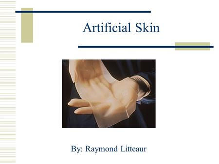 Artificial Skin By: Raymond Litteaur. History of Burns  Before artificial skin was developed, burns covering 50% of the body were considered to be fatal.