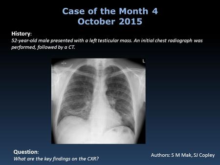 History : 52-year-old male presented with a left testicular mass. An initial chest radiograph was performed, followed by a CT. Question : What are the.