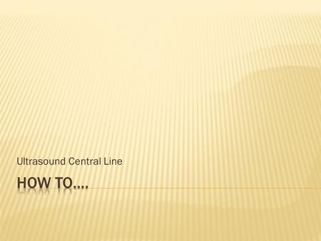 Ultrasound Central Line.  Most providers no longer use landmarks for central line placement except for with subclavian lines and occasionally femoral.