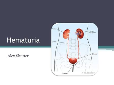 Hematuria Alex Shutter. What is Hematuria?? How do you get it?? -You can get it from infection, inflammation, or injury to the urinary system. -Kidney.