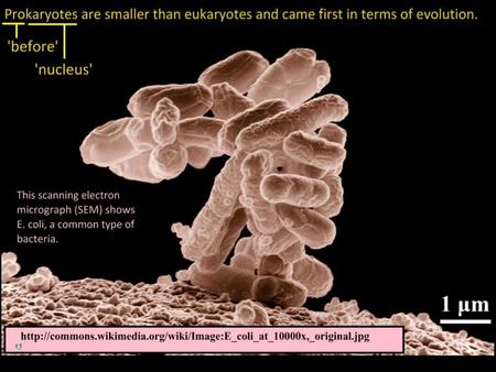 Draw and label a diagram of the ultrastructure of Escherichia coli (E