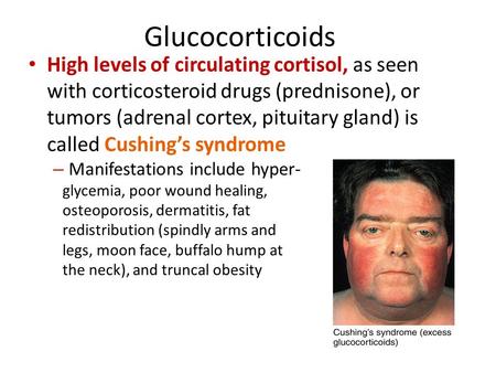 Glucocorticoids High levels of circulating cortisol, as seen with corticosteroid drugs (prednisone), or tumors (adrenal cortex, pituitary gland) is called.