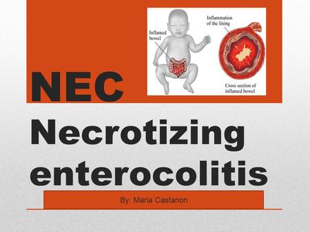 NEC Necrotizing enterocolitis By: Maria Castanon.