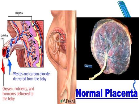 Normal Placenta.