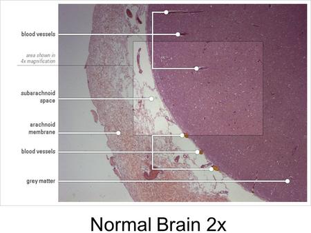 Normal Brain 2x. Normal Brain 4x Normal Brain 10x.