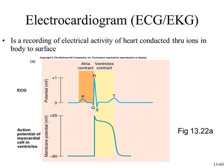 Electrocardiogram (ECG/EKG)