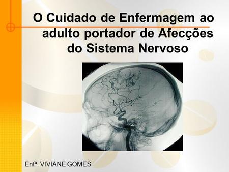 O Cuidado de Enfermagem ao adulto portador de Afecções do Sistema Nervoso Enfª. VIVIANE GOMES.