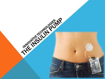 THE INSULIN PUMP INNOVATIVE TECHNOLOGIES. WHAT IS AN INSULIN PUMP? Machine delivery of insulin. Most commonly for those with Type one diabetes.