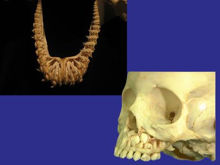 Tooth Attachment Thecodont - set in sockets Pleurodont - attach to side of jaw Acrodont - attach to occlusal surface.