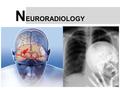 N EURORADIOLOGY. S TROKE ISCHEMICHEMORRHAGIC N ontraumatic intracranial hemorrhage HYPERTENSION RUPTURE ANEURYSM VASCULAR MALFORMATIONS COAGULOPATHY.