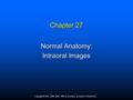 Copyright © 2012, 2006, 2000, 1996 by Saunders, an imprint of Elsevier Inc. Chapter 27 Normal Anatomy: Intraoral Images.