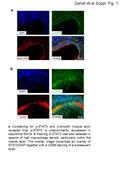 Daniel et al Suppl. Fig. 1 a b a Co-staining for p-STAT3 and α-smooth muscle actin revealed that p-STAT3 is predominantly expressed in neointimal SMCs.