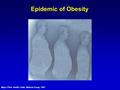 Epidemic of Obesity Mayo Clinic Health Letter, Medical Essay, 1997.