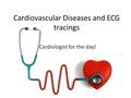 Cardiovascular Diseases and ECG tracings Cardiologist for the day!