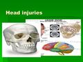 Head injuries.