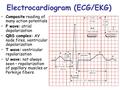 Electrocardiogram (ECG/EKG) Composite reading of many action potentials P wave: atrial depolarization QRS complex: AV node fires, ventricular depolarization.