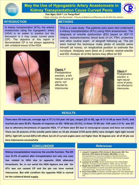 Tran Ngoc Sinh 1,2, Le Trong Khoi 2 1 Depts. of Urology, Cho Ray Hospital. 2 Faculty of Medicine and Pharmacy, Ho Chi Minh City, Vietnam. In kidney transplantation.