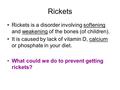 Rickets Rickets is a disorder involving softening and weakening of the bones (of children). It is caused by lack of vitamin D, calcium or phosphate in.