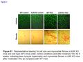 WT controlA3R KO control WT-TACA3R KO-TAC Fibrosis Cell size Figure S1 Figure S1. Representative staining for cell size and myocardial fibrosis in A3R.