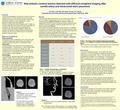 New embolic cerebral lesions detected with diffusion-weighted imaging after carotid artery and intracranial stent placement YH Chen, CJ Chen, DC Chen,