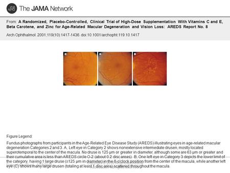 Date of download: 5/27/2016 Copyright © 2016 American Medical Association. All rights reserved. From: A Randomized, Placebo-Controlled, Clinical Trial.