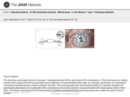 Date of download: 5/27/2016 Copyright © 2016 American Medical Association. All rights reserved. From: Characterization of Retrokeratoprosthetic Membranes.