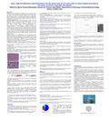 ABSTRACT Purpose: Synovial sarcomas (SS) constitute ~5-10% of soft tissue tumors with >90% SS having characteristic translocations due to the fusion of.