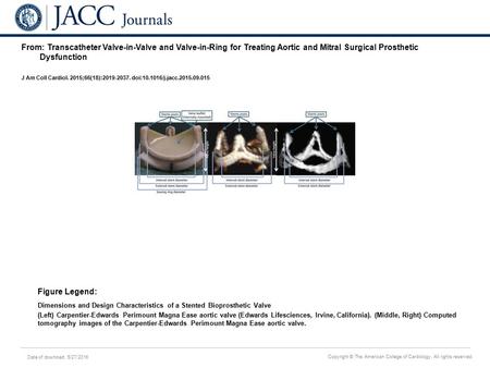 Date of download: 5/27/2016 Copyright © The American College of Cardiology. All rights reserved. From: Transcatheter Valve-in-Valve and Valve-in-Ring for.