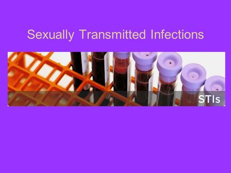 Sexually Transmitted Infections. What do you know???? What age group is at highest risk of getting an STD/STI?