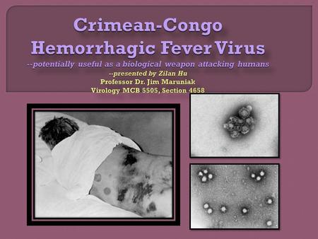 Crimean-Congo Hemorrhagic Fever Virus --potentially useful as a biological weapon attacking humans --presented by Zilan Hu Professor Dr. Jim Maruniak Virology.