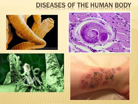 Diseases are caused by invading pathogens (aka: stuff that gets you sick) that affect, change or stop the functions of the organ systems.