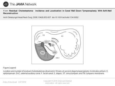 Date of download: 5/27/2016 Copyright © 2016 American Medical Association. All rights reserved. From: Residual Cholesteatoma: Incidence and Localization.