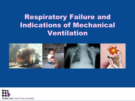 Respiratory Failure and Indications of Mechanical Ventilation 1.