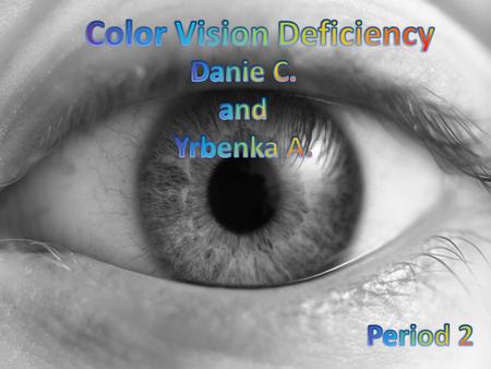 Color Vision Deficiency Is a condition where the retina (eye) is unable to distinguish colors correctly It can either affect seeing the red and green.