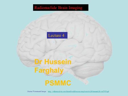 Dr Hussein Farghaly PSMMC Radionuclide Brain Imaging Master Watermark Image: