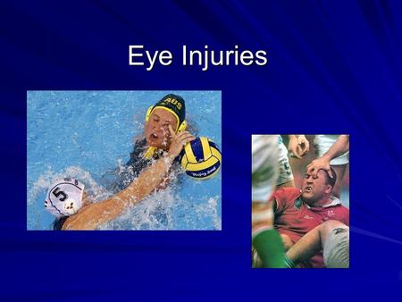 Eye Injuries. General Exam ~ inspect for swelling and deformity ~ palpate orbital rim ~ inspect globe of eye ~ inspect conjunctiva ~ determine pupil response.