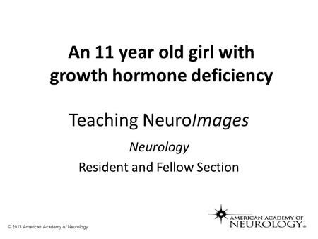 Teaching NeuroImages Neurology Resident and Fellow Section © 2013 American Academy of Neurology An 11 year old girl with growth hormone deficiency.