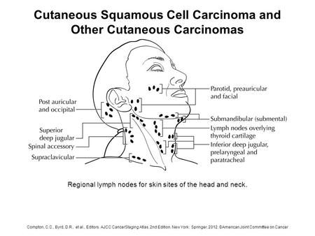 Cutaneous Squamous Cell Carcinoma and Other Cutaneous Carcinomas Regional lymph nodes for skin sites of the head and neck. Compton, C.C., Byrd, D.R., et.