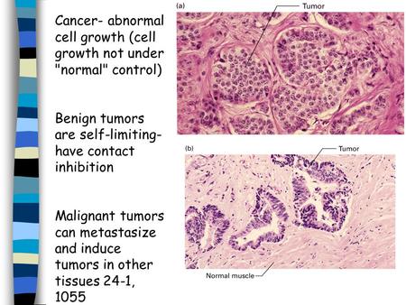 Cancer- abnormal cell growth (cell growth not under normal control) Benign tumors are self-limiting- have contact inhibition Malignant tumors can metastasize.