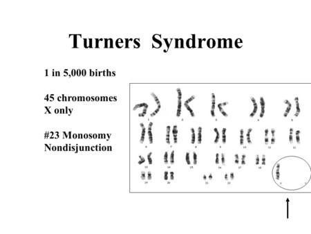 Turners Syndrome 1 in 5,000 births 45 chromosomes X only #23 Monosomy Nondisjunction.