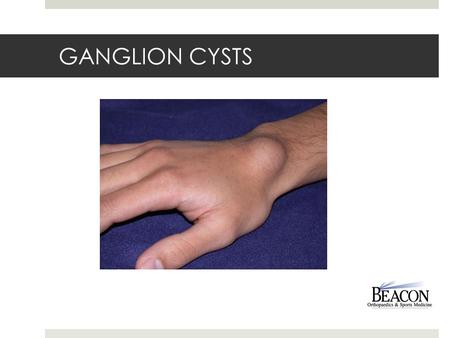 GANGLION CYSTS.