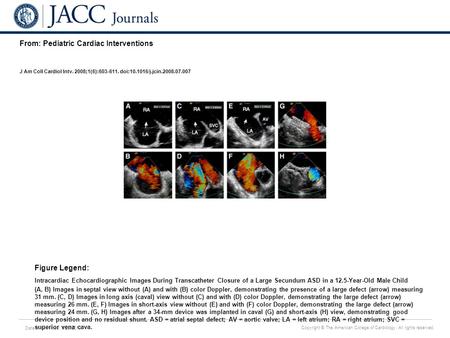 Date of download: 5/28/2016 Copyright © The American College of Cardiology. All rights reserved. From: Pediatric Cardiac Interventions J Am Coll Cardiol.