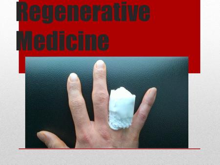 Regenerative Medicine. Overview What is Regenerative medicine? What can it do? How does it work? How does it help? What are the drawbacks? The future.