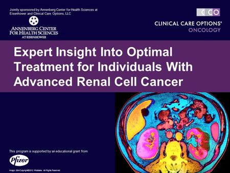 Expert Insight Into Optimal Treatment for Individuals With Advanced Renal Cell Cancer Jointly sponsored by Annenberg Center for Health Sciences at Eisenhower.