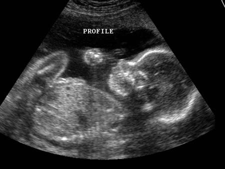 Ultrasound Learning Objectives: Describe the properties of ultrasound;