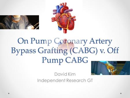 On Pump Coronary Artery Bypass Grafting (CABG) v. Off Pump CABG David Kim Independent Research GT.