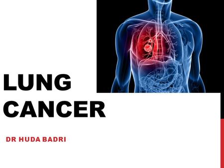 LUNG CANCER DR HUDA BADRI. OVERVIEW OF SESSION Learning objectives Quiz Tutorial on lung cancer and guidelines 15 minutes break Case studies 10minutes.