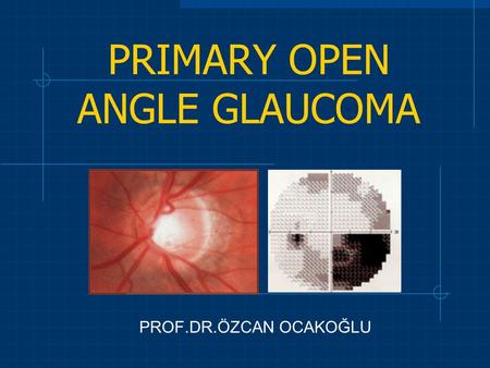 PRIMARY OPEN ANGLE GLAUCOMA PROF.DR.ÖZCAN OCAKOĞLU.