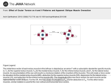 Date of download: 5/28/2016 Copyright © 2016 American Medical Association. All rights reserved. From: Effect of Ocular Torsion on A and V Patterns and.